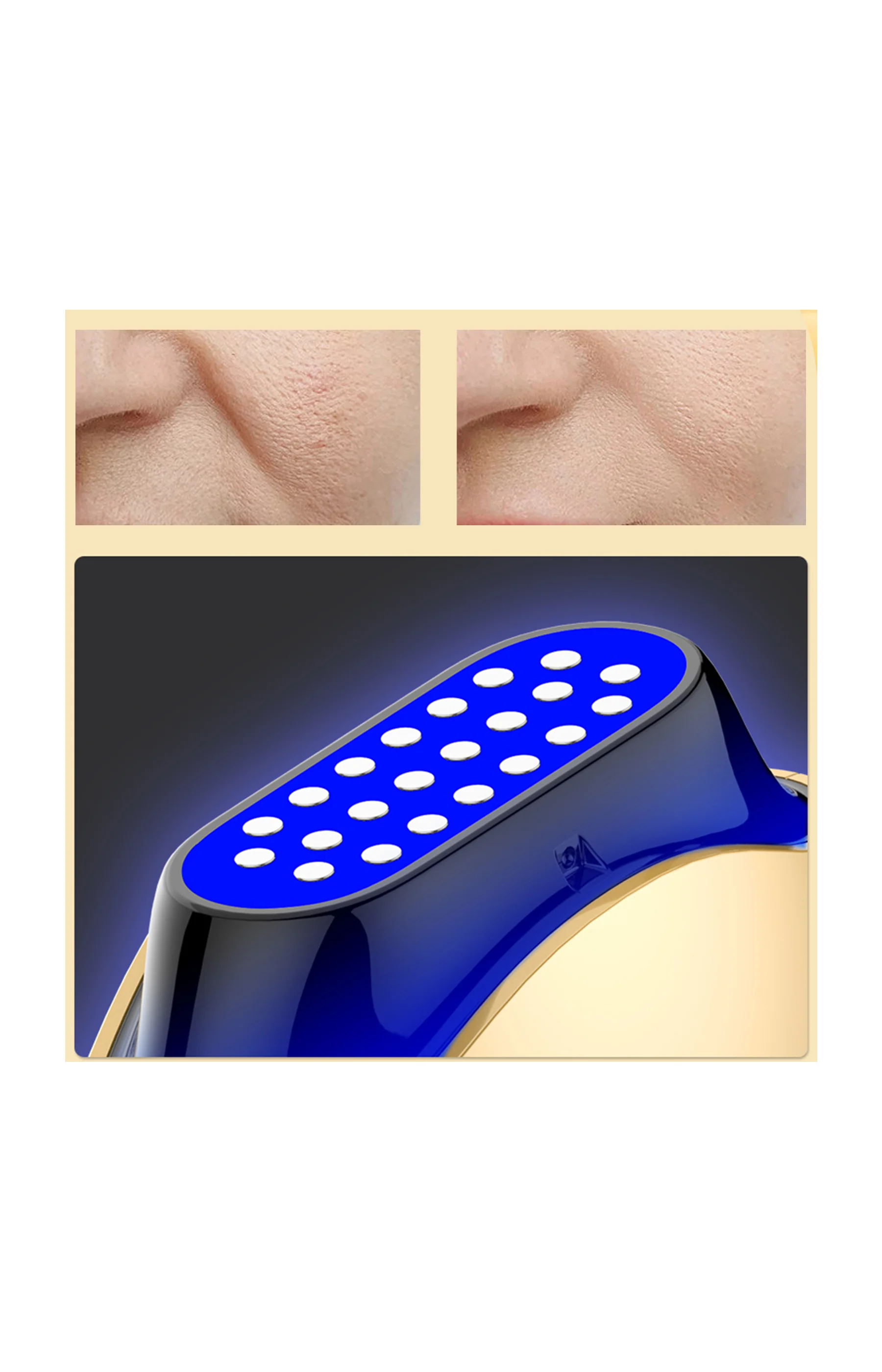 Appareil revitalisant - Visage - Doré - Image 4