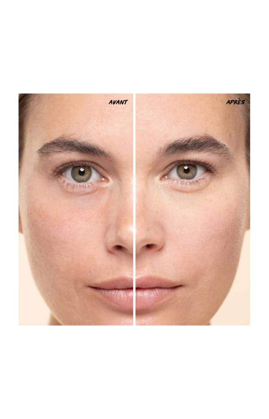 Correcteur multi-usages - Vitamin Fix Concealer - 100 Sand - 5 ml - Image 3