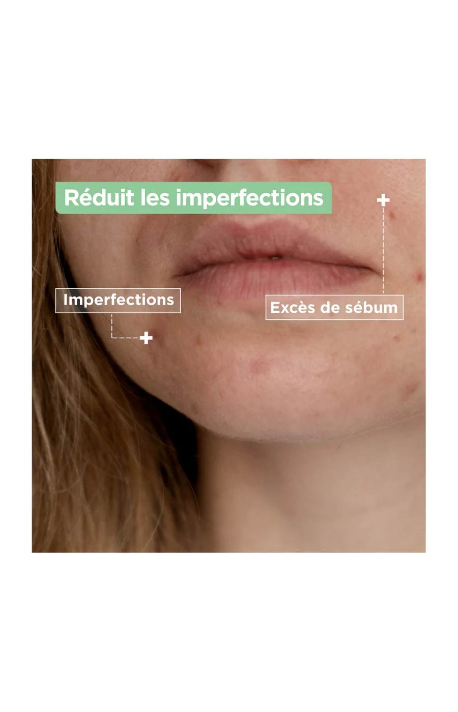Gel nettoyant anti-imperfections - Acide salicylique & squalane - Peaux mixtes à grasses - 200 ml - Image 4